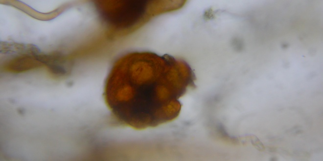 Picture of Dicranella staphylina tuber